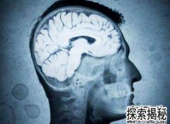 �����͸�����γ棬ʲô�Ǹ����͸�����γ�