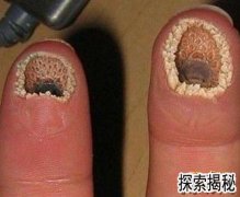 ����ָ������ָ��ʲô